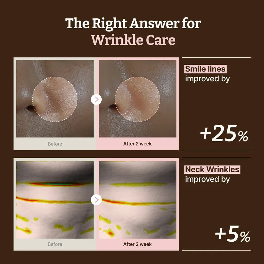 Dr. Reju-All advanced PDRN Rejuventing Mask