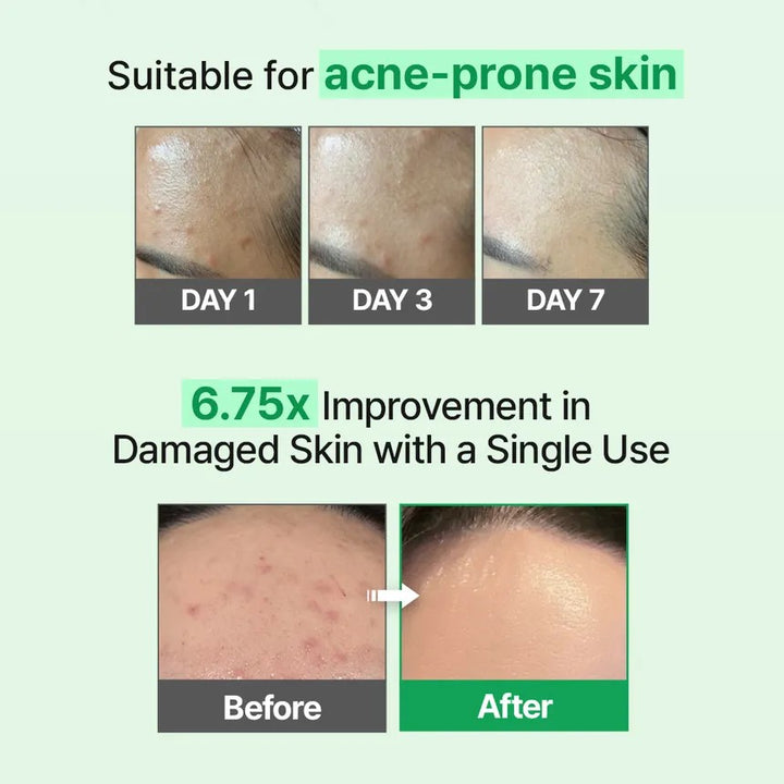 ZIPIDERM EGF Skin Barrier Intensive Cream