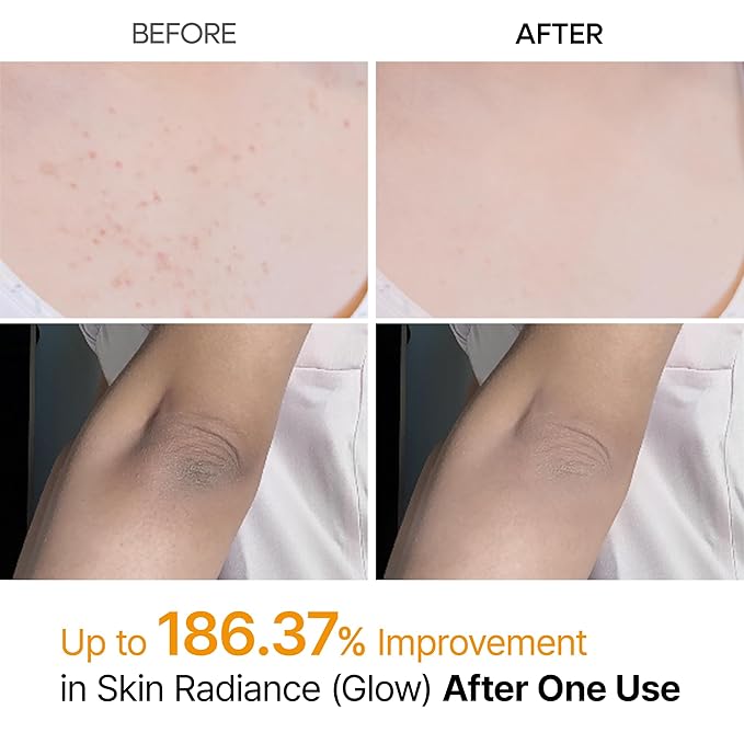 Dr.Melaxin Exfoliating Kojic Acid Turmeric Spray