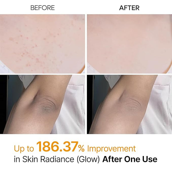 Dr.Melaxin Exfoliating Kojic Acid Turmeric Spray