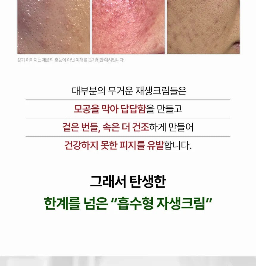 HEVEBLUE Derma Zinc Matcha MX Active Cream