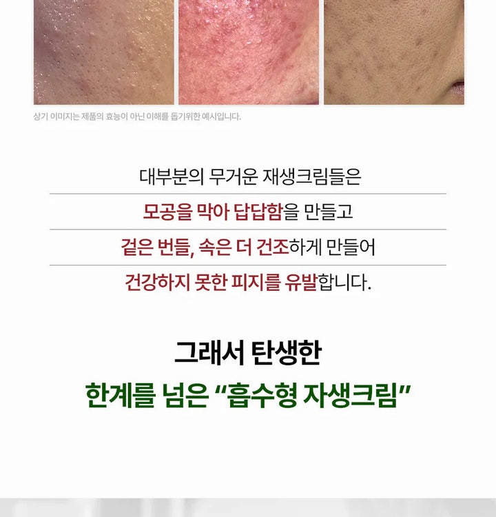 HEVEBLUE Derma Zinc Matcha MX Active Cream