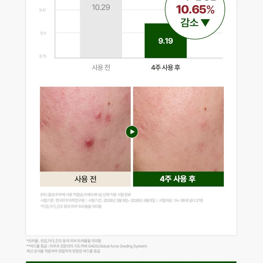 HEVEBLUE Derma Zinc Matcha MX Active Cream