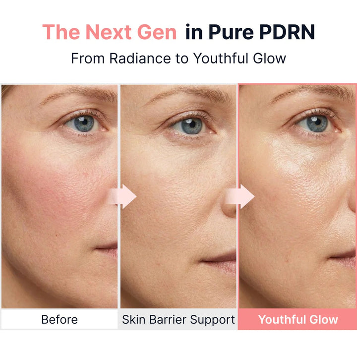 Sungboon Editor PDRN Pink Vitamin Glow Boosting Ampoule