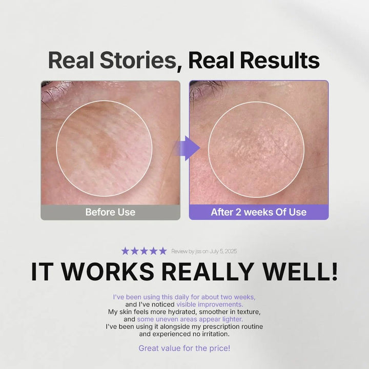 Genabelle Melacare Intensive Cream