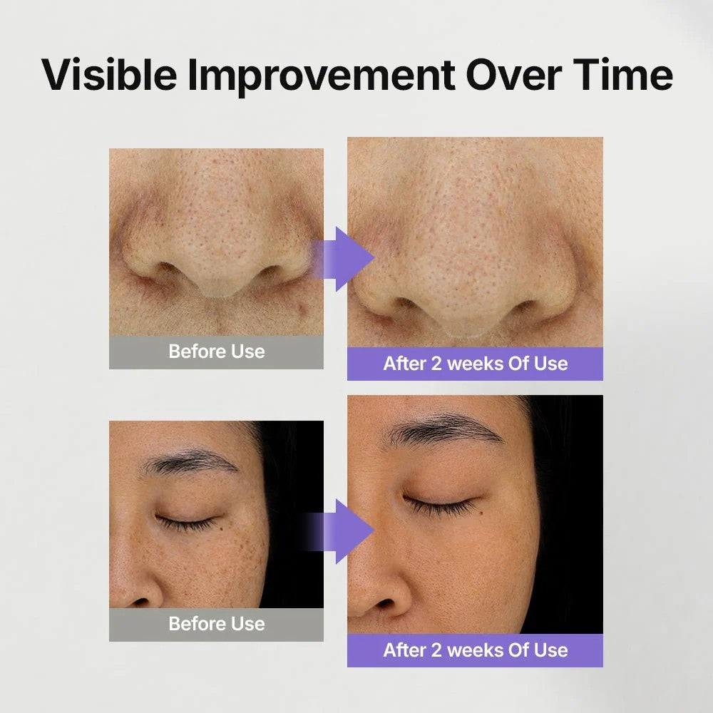 Genabelle Melacare Intensive Cream