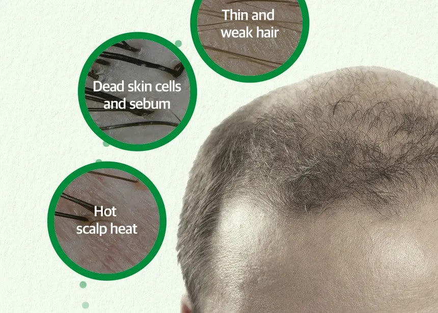 Some By Mi Cica Peptide Anti Hair Loss Derma Scalp Tonic
