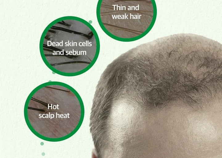 Some By Mi Cica Peptide Anti Hair Loss Derma Scalp Tonic