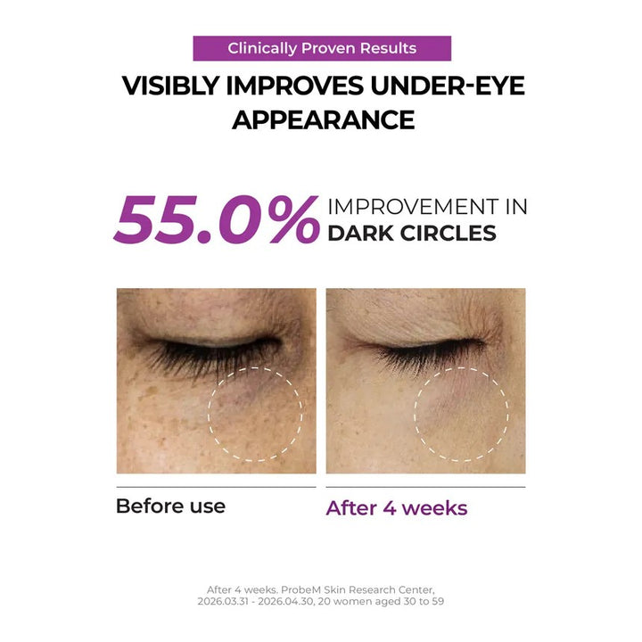 Niacinamide 5+Dark Circle Correcting Eye Cream