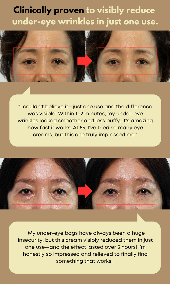 NINE LESS Ever-Youth Dual Effect Eye Cream