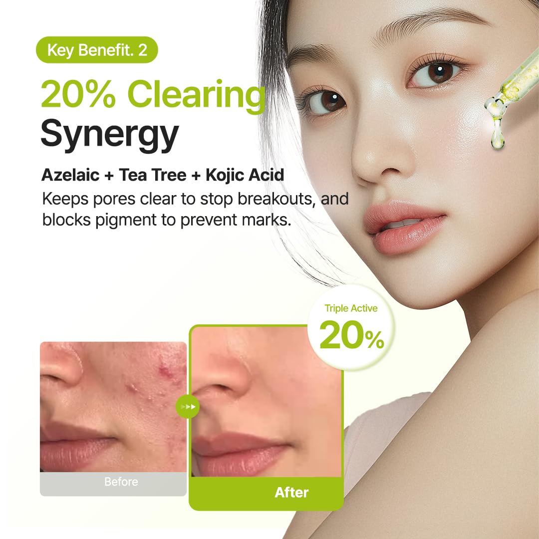 Purito Azelaic Acid 10 Kojic Tea Tree Serum