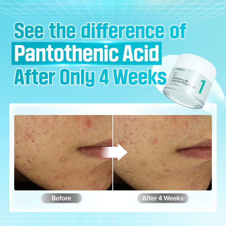 Numbuzin No. 1 Pantothenic B5 Soothing Cream 80ml
