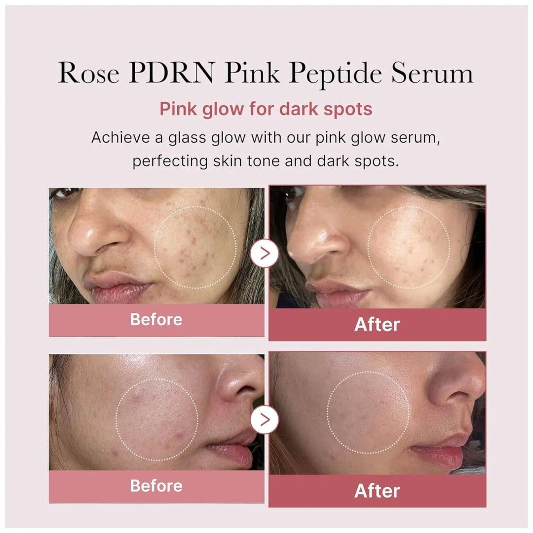 medicube - PDRN Pink Peptide Serum