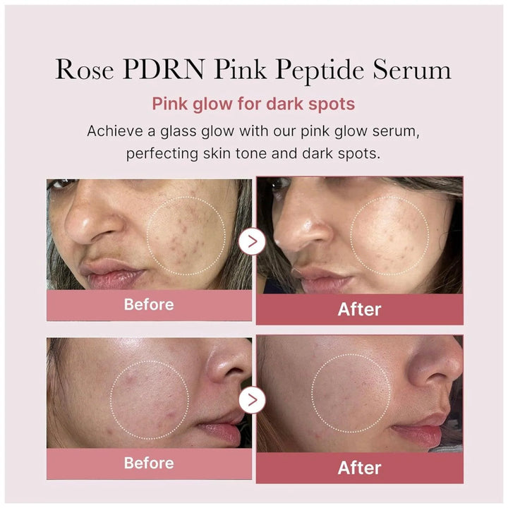 medicube - PDRN Pink Peptide Serum