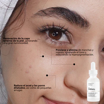 Niacinamida 10% + Zinc 1% The Ordinary