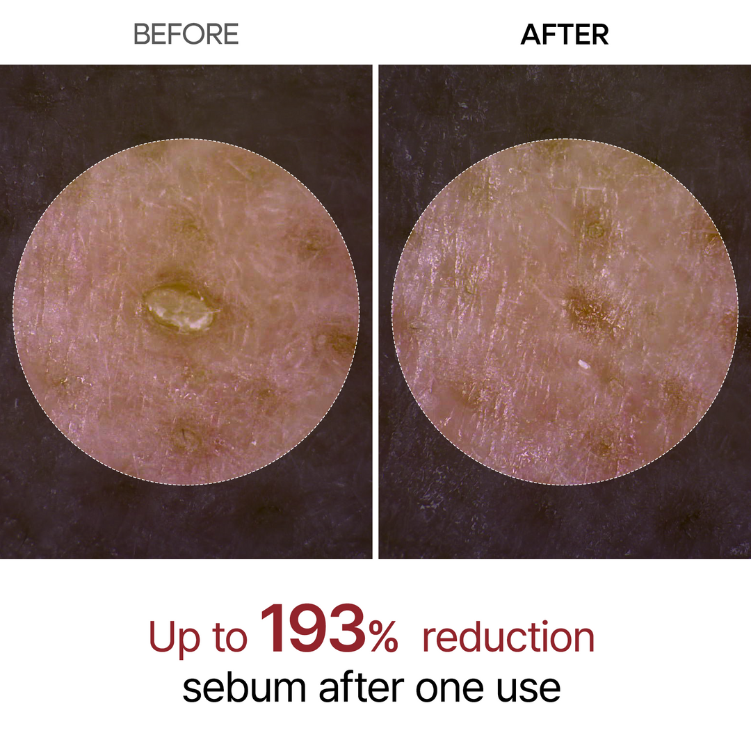 Dr.Melaxin - Peel Shot Exfoliant Black Rice Ampoule