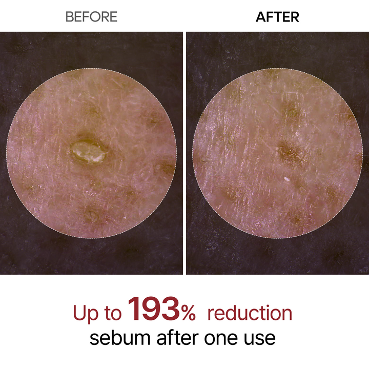 Dr.Melaxin - Peel Shot Exfoliant Black Rice Ampoule