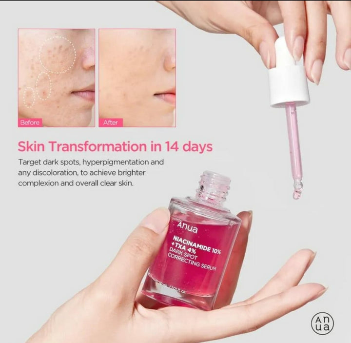 ANUA Niacinamide 10% + TXA 4% Dark Spot Correcting Serum