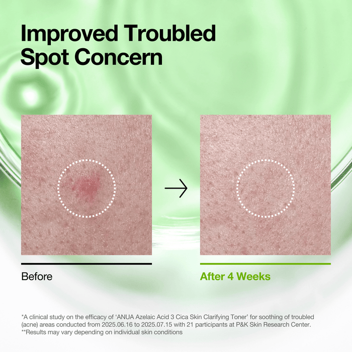 Anua - Azelaic Acid 3 Cica Skin Clarifying Toner