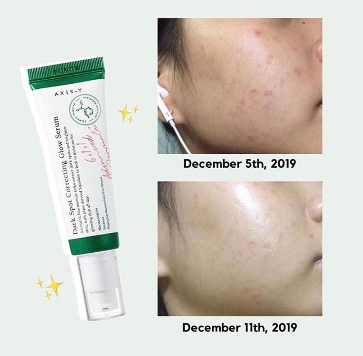AXIS-Y DARK SPOT CORRECTING GLOW SERUM 50ML