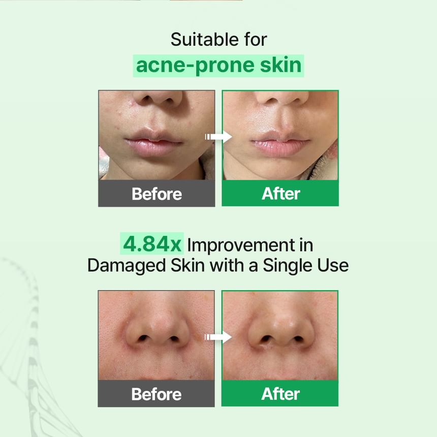Zipiderm - EGF Skin Barrier Cream Toner