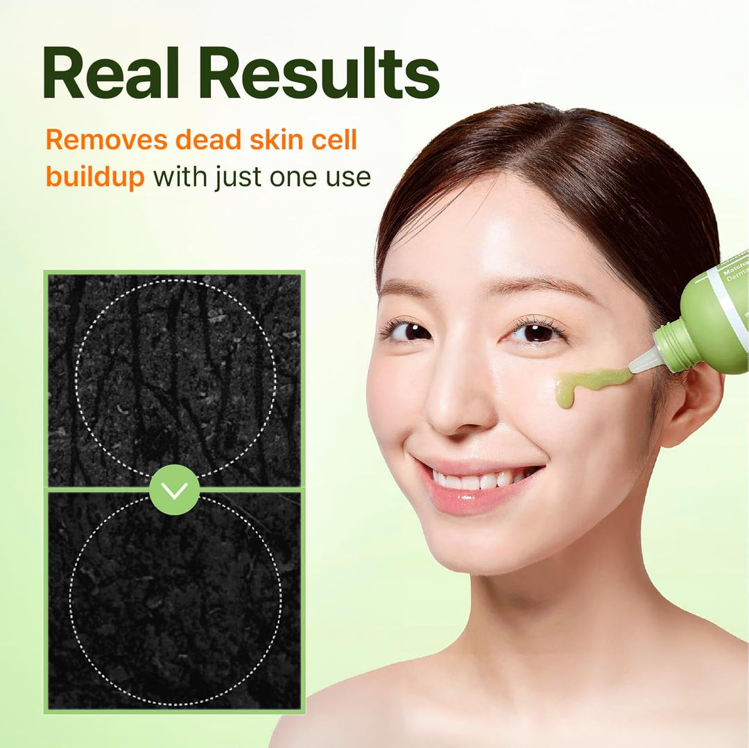 CENTELLIAN 24 Madeca Matcha Gel Peeling