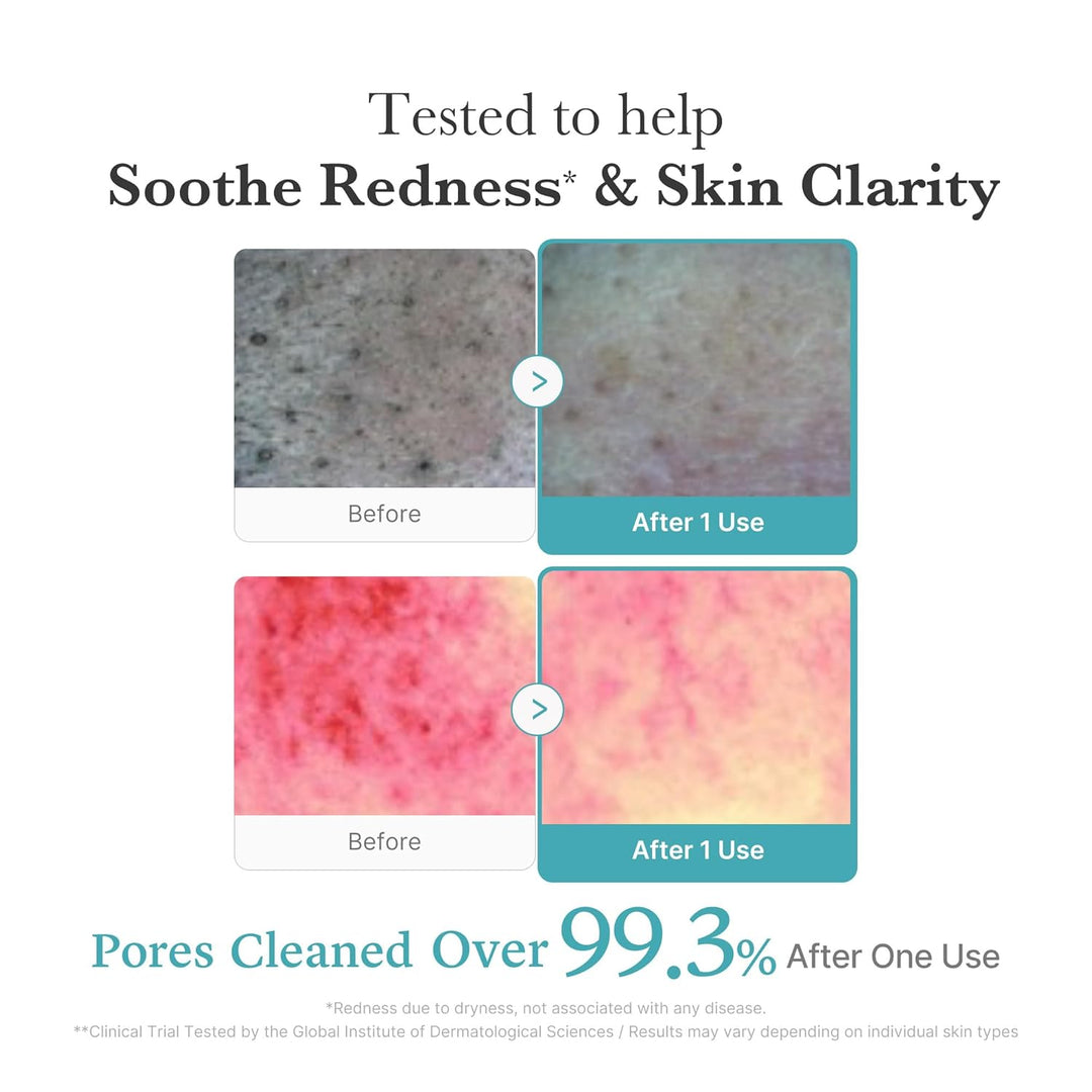 MEDICUBE – Azelaic Acid Niacinamide Deep Clean Foam Cleanser