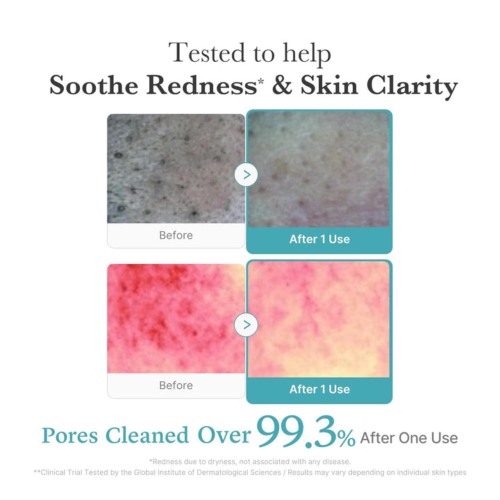 MEDICUBE – Azelaic Acid Niacinamide Deep Clean Foam Cleanser